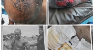 beaten,-abandoned,-then-charged:-the-ordeal-of-fredrick-namara-karuhanga-under-the-shadow-of-updf’s-major-mark-wanyama-–-xavier-radio-ug